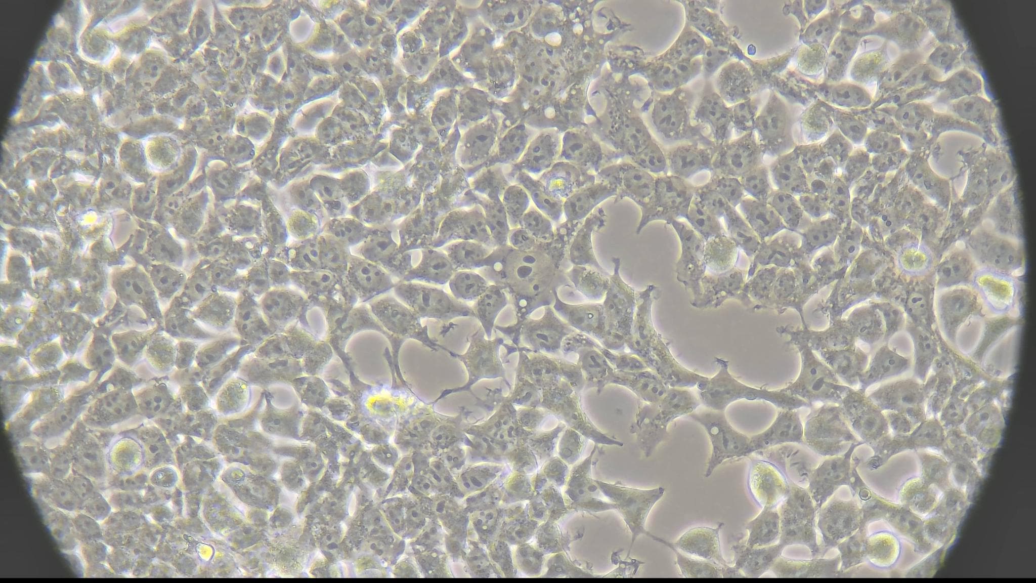 IP-Free HEK 293 Human Embryonic Kidney Cell Line